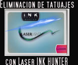 Eliminacion de tatuajes       con Laser INK HUNTER